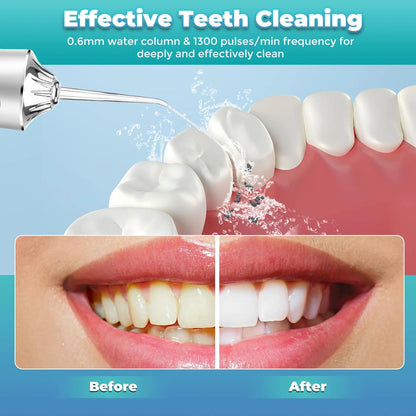 Water Dental Flosser | Cordless and rechargeable | High pressure tooth flusher with 4 nozzles and 3 modes.